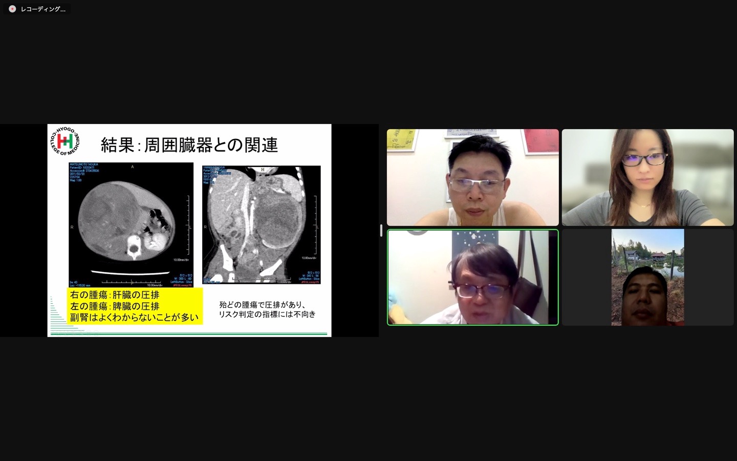 図 3　コンサルテーションを受けた症例についてオンラインでディスカッションする様子